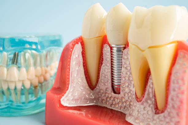 Oral Surgery in Harwood Heights, IL